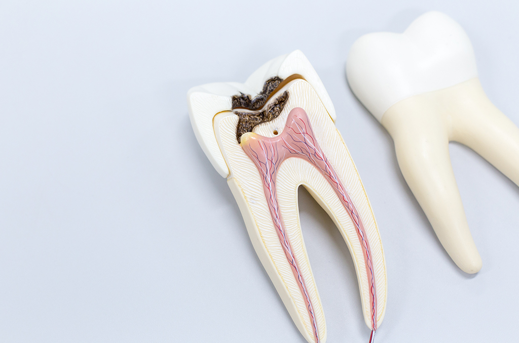 imagen para pagina de endodoncia
