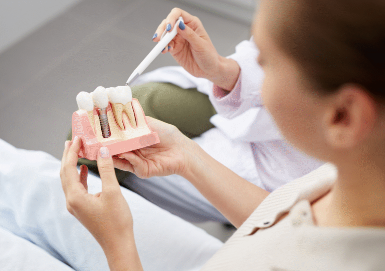 implantes dentales